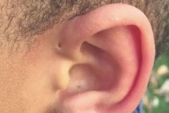 Kelebihan Langka Ini Hanya Dimiliki Sebagian Kecil Manusia di Muka Bumi, Amazing!