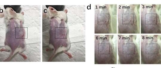 Alat Penyelamat Hidup Pasien Kanker, Dengan Metode Teknologi Microneedles