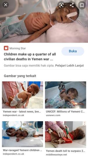 Akui Sedih Melihat Kelaparan di Yaman, Ferdinand : Indonesia Tak Ingin Jadi Penengah?