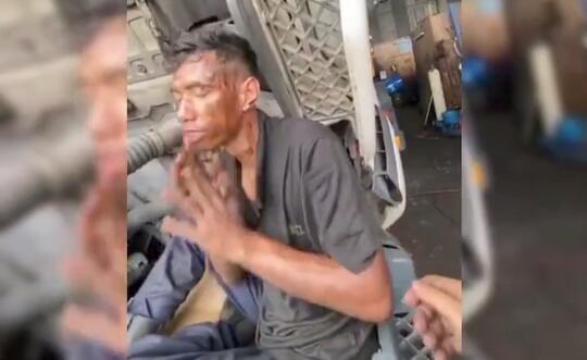 Viral Pria Cuci Muka dengan Oli karena Latah, Ini Pengertian Latah Menurut Ilmu Medis