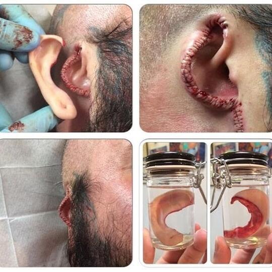 Serem, Pria ini Potong Kedua Kupingnya Lalu Diawetkan di Toples Hanya Demi Seni?