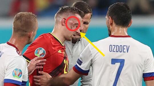 Bek Belgia Castagne, Mungkin Absen di Kompetisi EURO 2020, Akibat Cedera Soket Mata