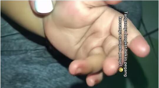 Bayi Makan Kecoa Sebab Kurang Pengawasan, Kisah yang Dibagikan Ibu Ini Jadi Pelajaran