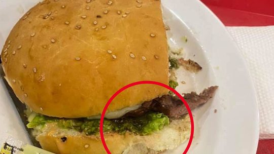 Setelah Viral-nya Penemuan Jari Dalam Burger, Polisi Pun Beberkan Faktanya