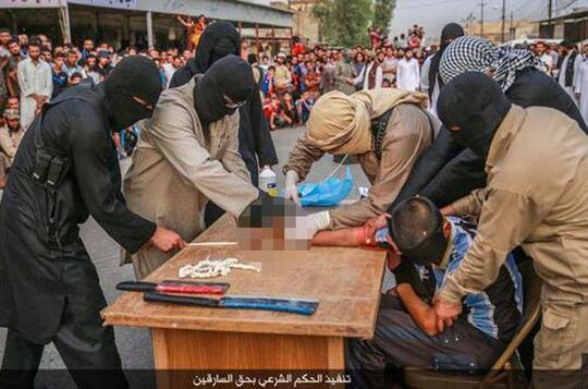 Taliban Pastikan Hukuman Potong Tangan-Kaki Akan Berlaku Lagi