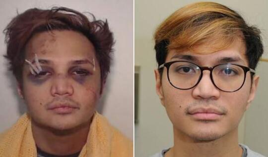 Wajah Predator Seksual Reinhard Sinaga Babak Belur