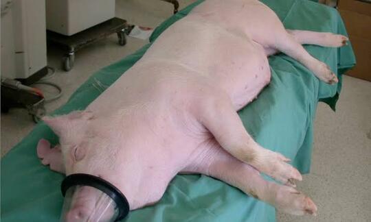 Dokter di Amerika Berhasil Transplantasikan Ginjal BABI ke Manusia, Amazing Amat Gaes