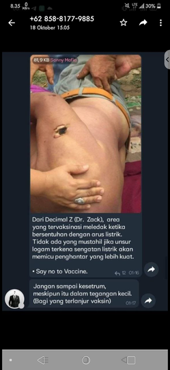 Tanya berita "VAKSIN MELEDAK KETIKA KESETRUM" bener apa gak?