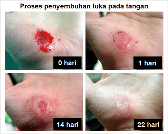 Axolotl Hewan Yang Bisa Beregenerasi Seperti Deadpool