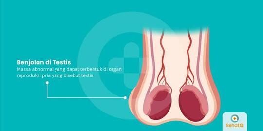 Testis Kecil, Apa Penyebabnya Ya Apakah Berbahaya?