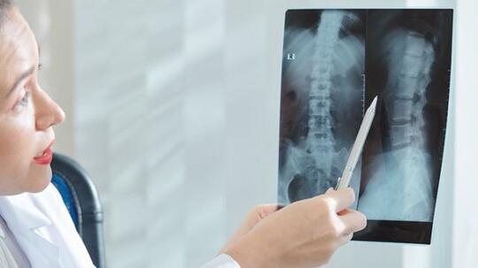 Fakta-Fakta Mengenai Spinal Cord Injury Yang Dialami Mendiang Selebgram Laura Anna