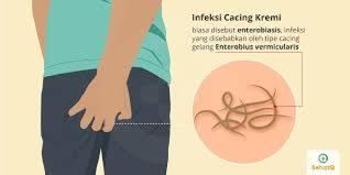 Bukan Belatung, Tapi Cacing Kremi Yang Bisa Berada Di Vagina!