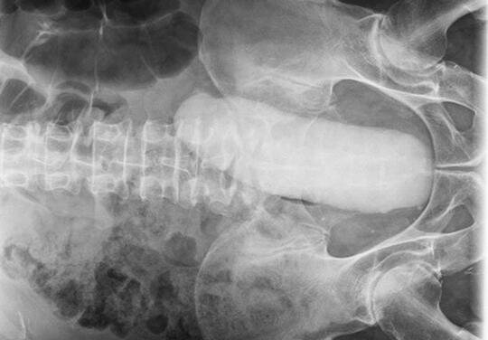 Nafsu Liar. Dildo sampai Nyangkut di Dalam