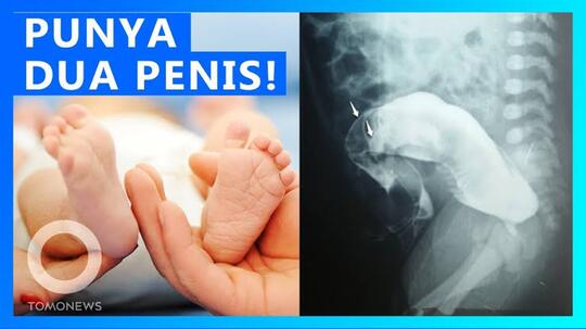 Evelyn Miller Seorang Model Dewasa, Yang Mempunyai Dua Vagina!