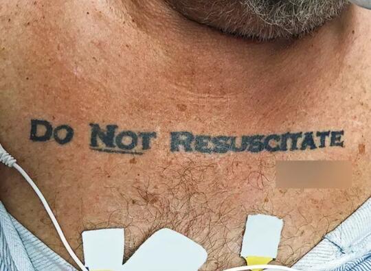 Mengenal Tindakan Medis "Do Not Resuscitate" #RabuRandom