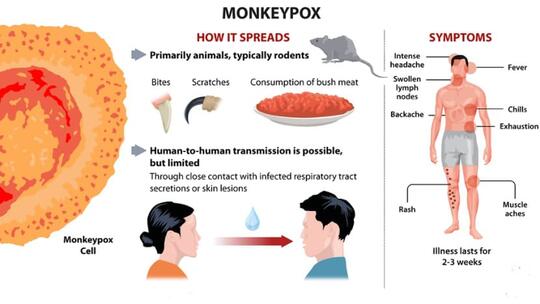 Waspada, Virus Monkeypox atau Cacar Monyet Semakin Menyebar di Eropa dan Amerika