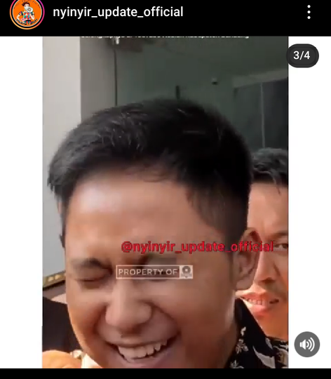 Doni Salmanan Menjadi Sorotan Mata Sering Berkedip, Yuk Kenali Apa Penyebabnya