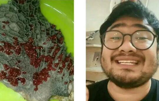 Beredar Video Terdapat Banyak Cacing Merah Pada Babat Sapi, Apakah Itu Berbahaya?